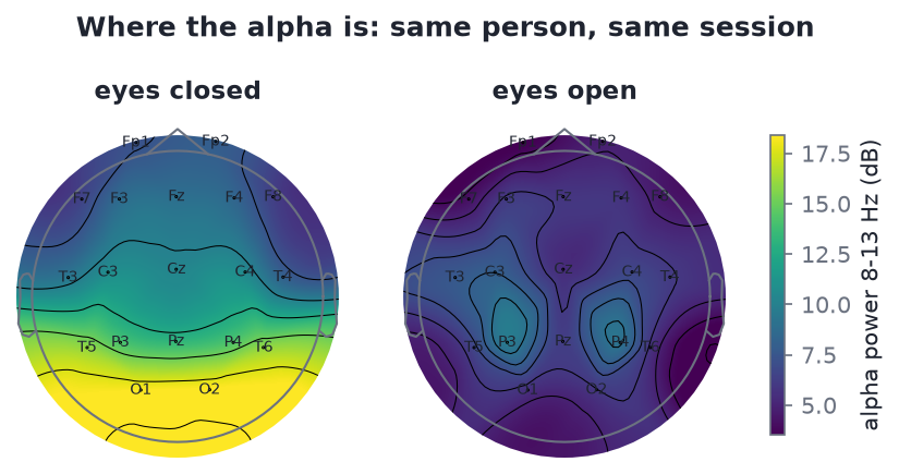 Alpha power topomaps, eyes closed and eyes open, same colour scale