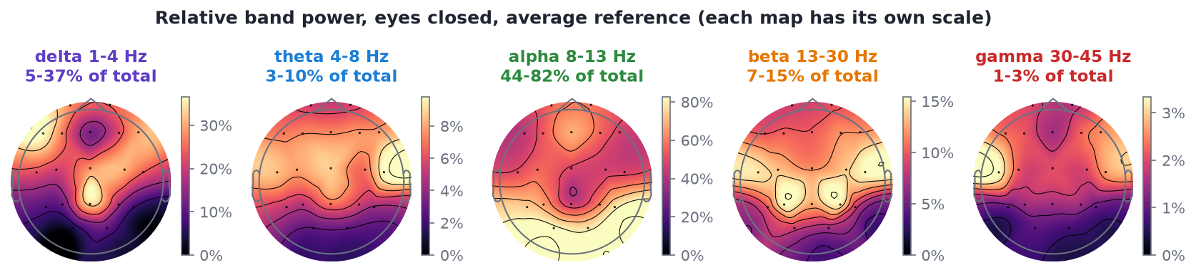 Relative band power topomaps for delta, theta, alpha, beta and gamma, eyes closed