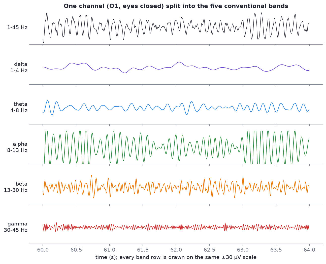 One channel of eyes-closed EEG (O1) split into delta, theta, alpha, beta and gamma bands, all on the same ±30 µV scale