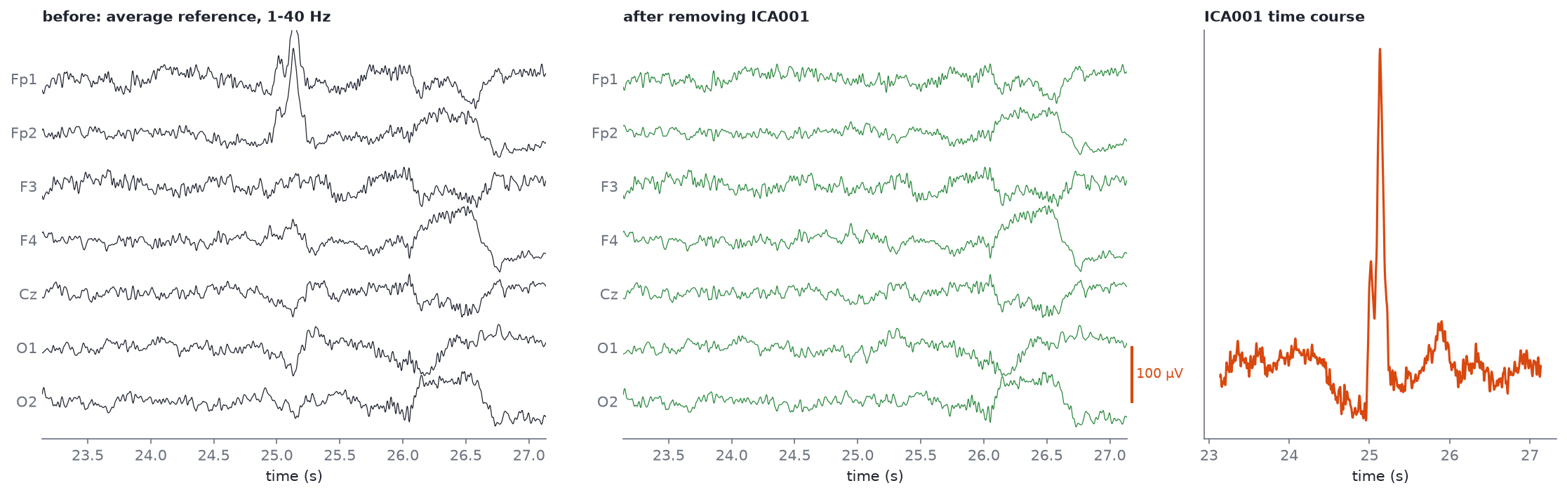 Seven channels before and after removing the blink component, and the component's time course