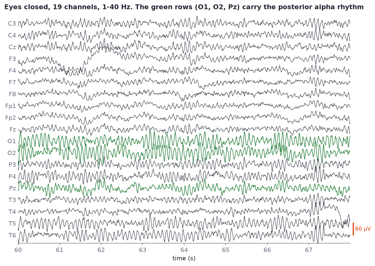 Eight seconds of eyes-closed EEG, 19 channels, with O1, O2 and Pz highlighted in green